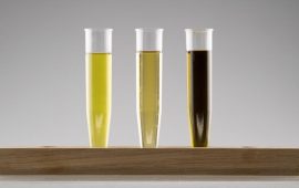 Does CBD Show Up In A Urine Test?